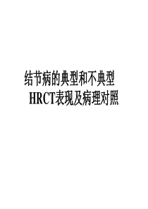 肺结节病的典型和不典型HRCT表现及病理对照