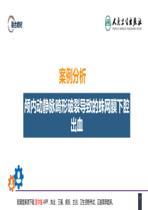 第二十章 案例分析-颅内动静脉畸形破裂导致的蛛网膜下腔出血