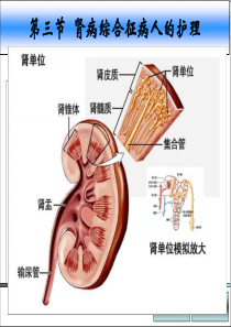 肾病综合征PPT