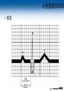 护理心电图讲座