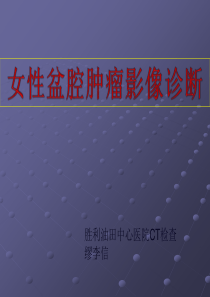 女性盆腔肿瘤的影像学表现及鉴别