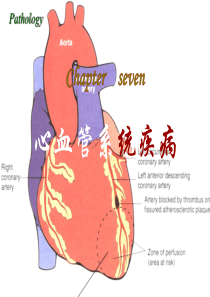 病理学(第八版)最新课件心血管系统疾病