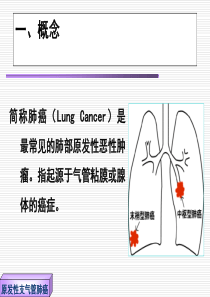 原发性支气管肺癌病人的护理完