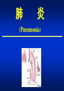 支气管肺炎--ppt课件