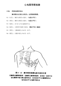 心电图导联连接快速确定位置及图示