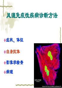 抗核抗体检测及临床意义-张瑾