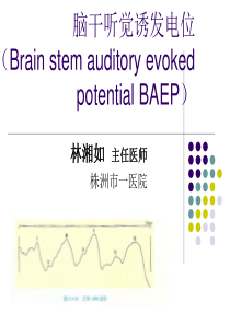 脑干听觉诱发电位