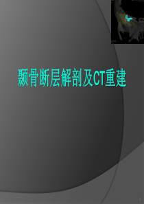 颞骨断层解剖及CT三维重建.