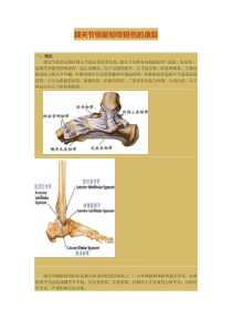 踝关节侧副韧带损伤的康复