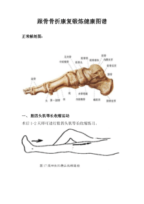 跟骨骨折康复锻炼健康图谱