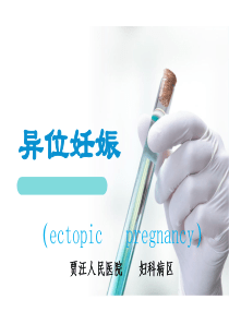 异位妊娠-PPT课件(1)888ok解析