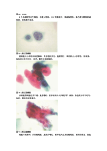 液基薄层宫颈细胞学3