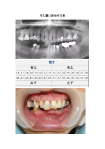 治疗方案模板