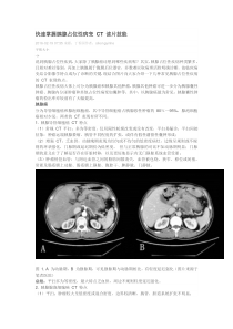 快速掌握胰腺占位性病变CT读片技能