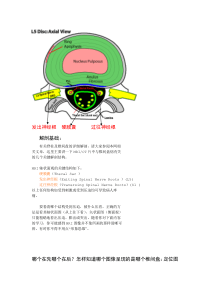 怎样看椎间盘CT片