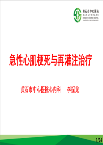 急性心肌梗死与再灌注治疗.