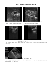 兽用B超在奶牛卵巢疾病诊断中的应用