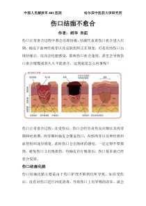 伤口结痂不愈合