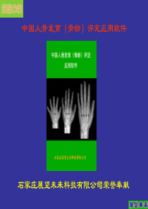 中国人手腕骨发育标准CHN法》标准文本及相关资料.