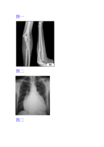 三个X线的诊断