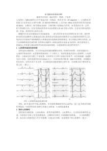 ST段提高的鉴别诊断