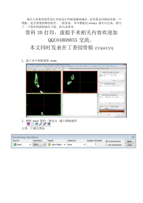 mimics手术导板制作,简单易行