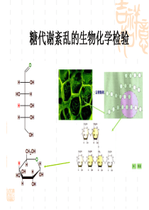 2糖代谢紊乱的生物化学检验