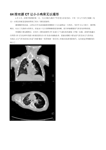 64排双源CT让小小鸡骨无以遁形(修改后)