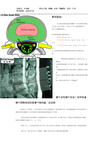 7月椎间盘突出CT_MRI解读