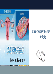 95多囊卵巢综合征