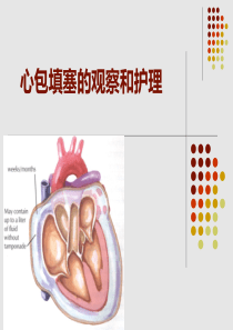 心包填塞和心包引流的护理