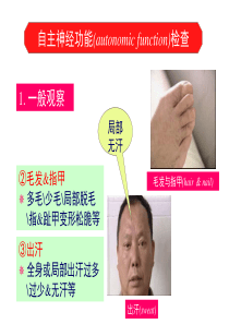 第三章 神经病学临床检查法3