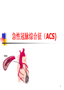 78急性冠脉综合征