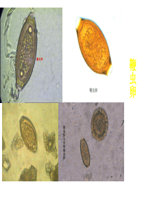 人体寄生虫学实验考试