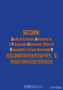 SATURN研究解读