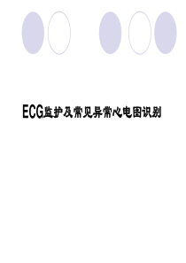 ECG监护及常见异常心电图的识别1