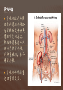 简介肾移植