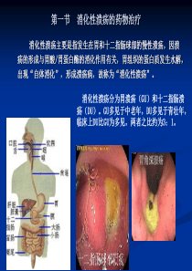 消化系统常见疾病的药物治疗-PPT文档资料