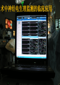 术中神经电生理临床演示-骨科