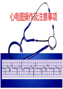 心电图检查操作及注意事项.ppt