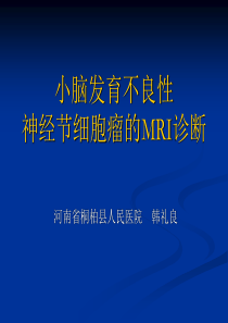 小脑发育不良性神经节细胞瘤的MRI表现