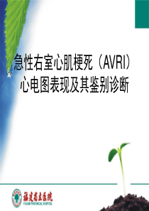 急性右室心肌梗死(AVRI)心电图表现及其鉴别诊断