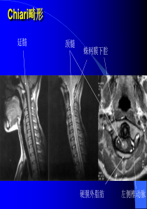 脑部MRI图像