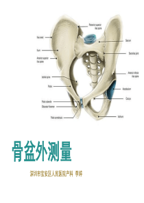 51骨盆外测量