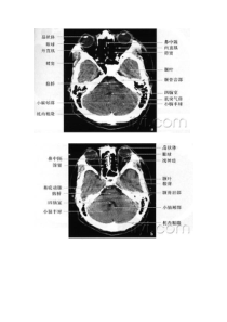 不做文盲医生,细学CT、MRT