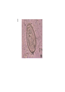 寄生虫 图谱复习1
