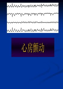 心房颤动课件PPT