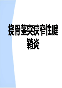 挠骨茎突狭窄性腱鞘炎