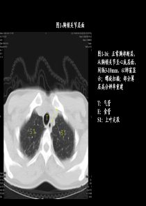 医疗不良事件报告制度的建立