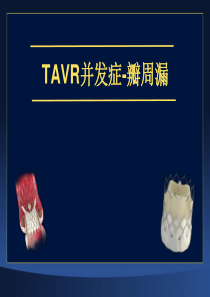 TAVR并发症-瓣周漏